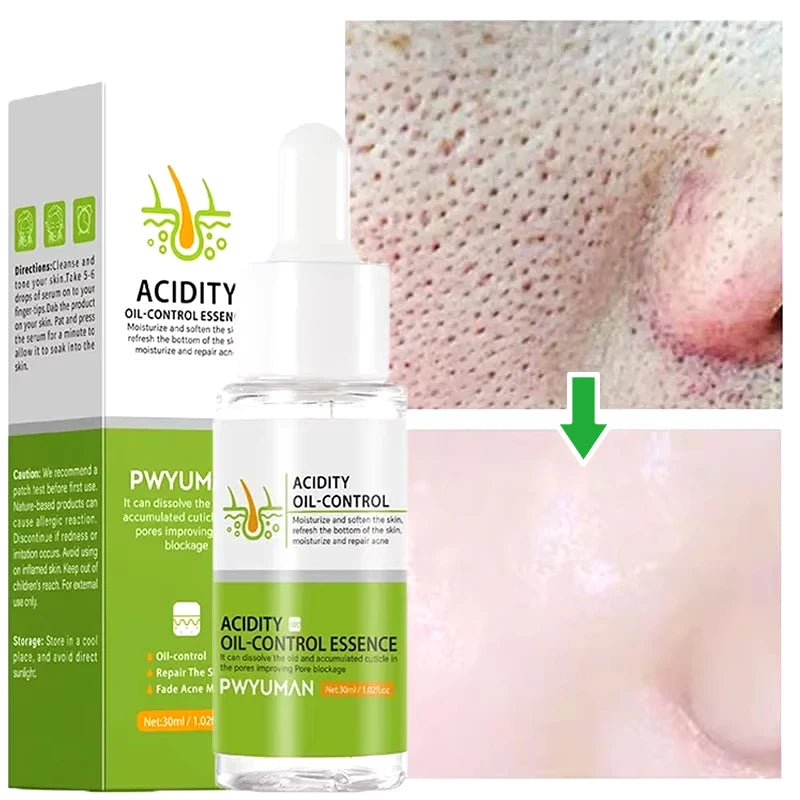 Salicylic Acid