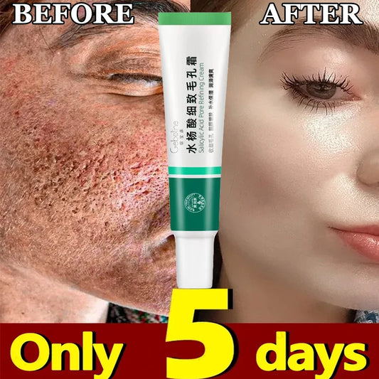 Salicylic Acid